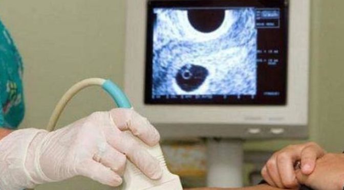 Perbedaan USG ANC Trimester Pertama, Kedua, dan Ketiga